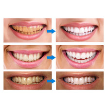 Load image into Gallery viewer, Teeth Whitening Pens