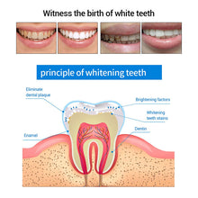 Load image into Gallery viewer, Teeth Whitening Pens